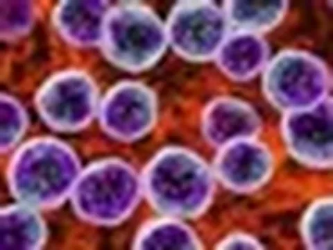 Một bệnh viện trung ương ghi nhận nhiều ca ung thư có chung một đặc điểm trên da