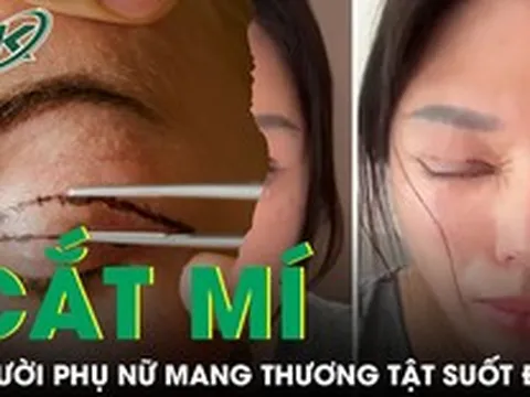 Tin lời 'chuyên gia' thẩm mỹ, người phụ nữ nhận kết cục đau đớn sau cắt mí mắt