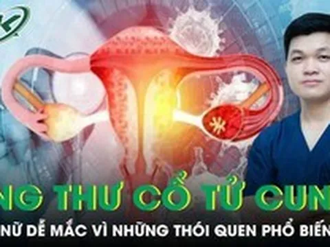 Phụ nữ dễ mắc ung thư cổ tử cung vì những thói quen phổ biến này