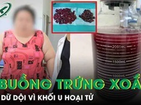 Cô gái nặng 120kg đau bụng dữ dội vì hoại tử khối u buồng trứng xoắn 20cm