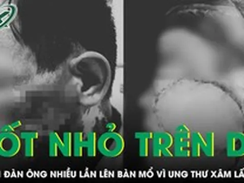 Chủ quan với nốt nhỏ trên da, người đàn ông nhiều lần phẫu thuật ung thư xâm lấn tái phát