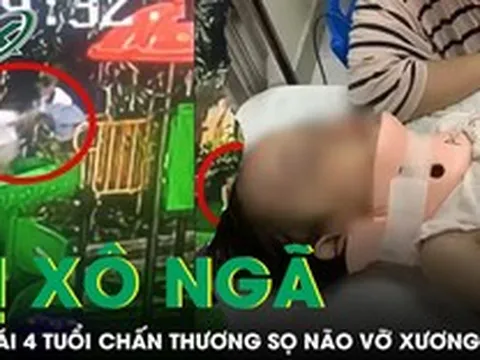 Bé gái 4 tuổi bị bạn xô ngã từ cầu trượt cao 1,5m chấn thương sọ não vỡ xương trán