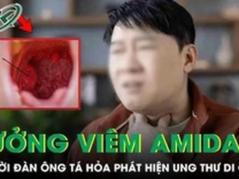 Tưởng viêm amidan, người đàn ông 60 tuổi 'chết lặng' phát hiện ung thư di căn