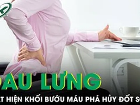 Đau lưng kéo dài, người phụ nữ phát hiện khối bướu máu đã phá hủy gần toàn bộ đốt sống
