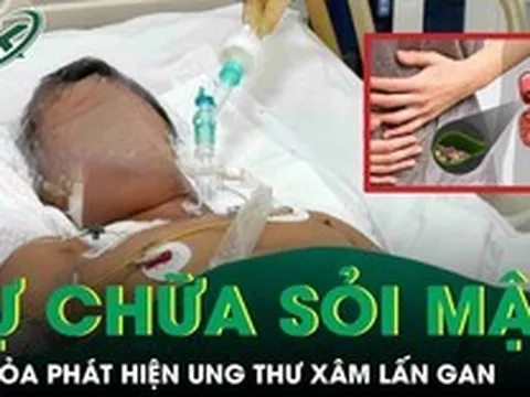 Tự chữa sỏi mật tại nhà, người đàn ông tá hỏa phát hiện ung thư xâm lấn gan