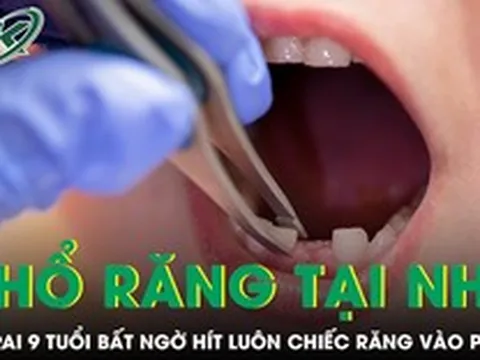 Được mẹ nhổ răng tại nhà, bé trai 9 tuổi bất ngờ hít luôn chiếc răng vào phổi