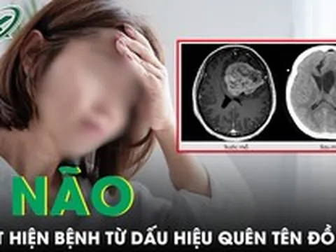 Liên tục quên tên đồ vật quen thuộc, người phụ nữ phát hiện khối u não nguy hiểm