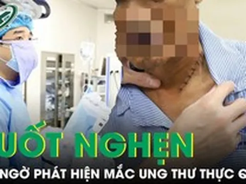 Nuốt nghẹn khi ăn, không ngờ phát hiện mắc ung thư thực quản xâm lấn nguy hiểm