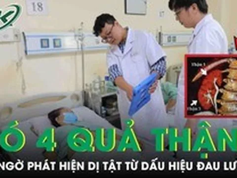 Người phụ nữ bất ngờ phát hiện mình có 4 quả thận từ dấu hiệu đau hông lưng
