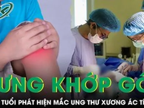 Sưng khớp gối kéo dài, bé trai 6 tuổi phát hiện mắc ung thư xương ác tính