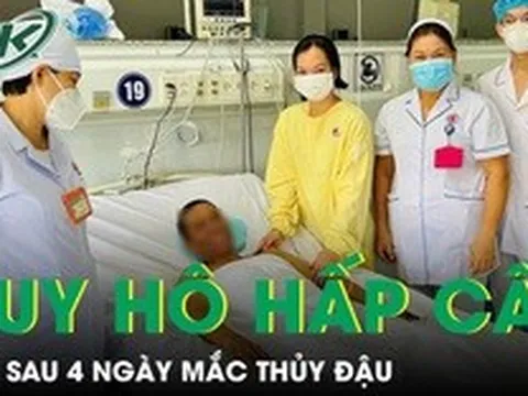 Người đàn ông suy hô hấp cấp chỉ sau 4 ngày mắc thủy đậu