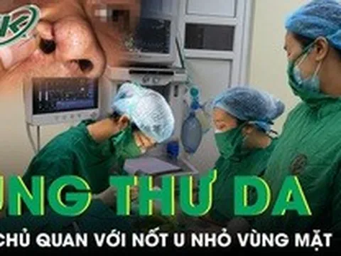 Chủ quan với nốt u nhỏ, người bệnh phát hiện ung thư da vùng mặt