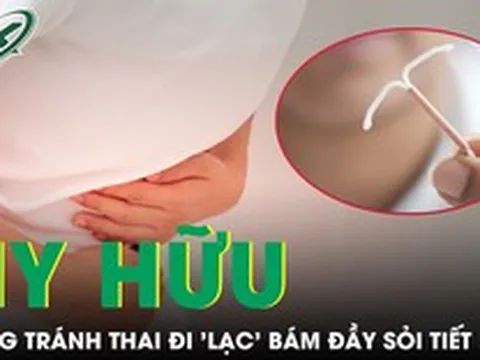 Ngỡ viêm đường tiết niệu, người phụ nữ bất ngờ phát hiện vòng tránh thai 'lạc' vào bàng quang