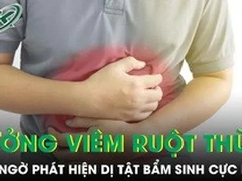 Đau bụng tưởng viêm ruột thừa cấp, bất ngờ phát hiện mắc dị tật bẩm sinh chỉ 2% người mắc