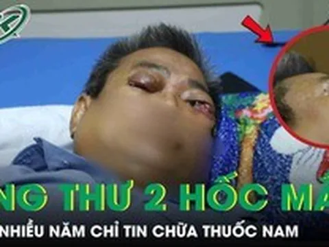 Người đàn ông 61 tuổi ung thư 2 hốc mắt sau nhiều năm chỉ tin chữa thuốc nam