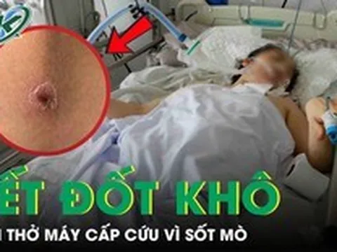 Người phụ nữ 49 tuổi lâm bạo bệnh, phải thở máy cấp cứu chỉ từ một vết đốt khô