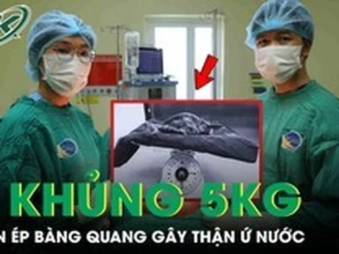 Người phụ nữ 53 tuổi mang khối u xơ tử cung khổng lồ nặng gần 5kg chèn ép bàng quang