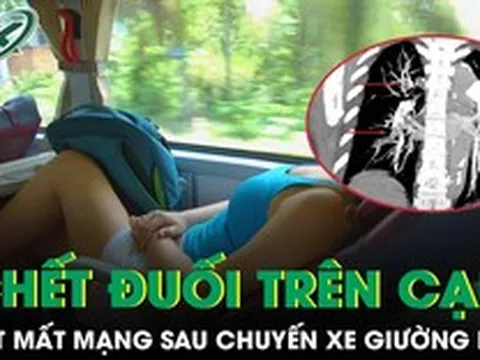 Người phụ nữ suýt mất mạng vì "chết đuối trên cạn" sau chuyến xe giường nằm kéo dài