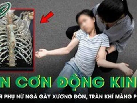 Người phụ nữ ngã gãy xương đòn, tràn máu màng phổi vì lên cơn động kinh