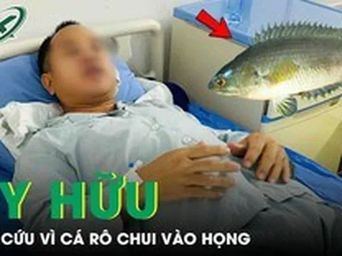 Cá rô chui vào họng, người đàn ông 39 tuổi cấp cứu trong đau đớn