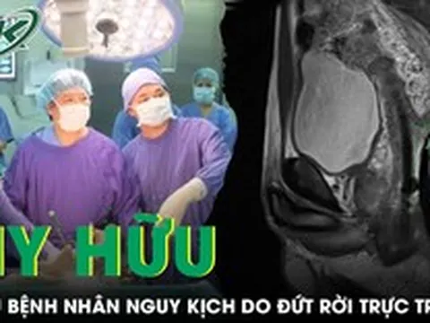 Cứu bệnh nhân nguy kịch do đứt rời trực tràng sau phẫu thuật