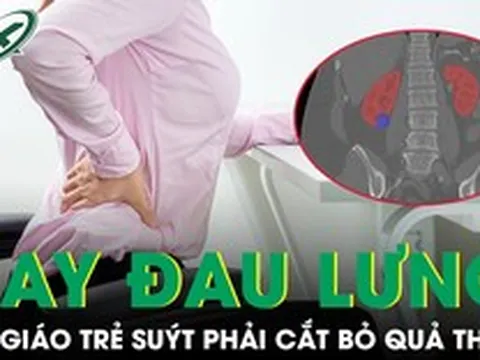 Đau lưng kéo dài nhưng chủ quan, cô giáo trẻ suýt phải cắt bỏ quả thận