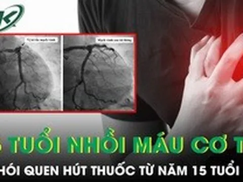 Hút thuốc từ năm 15 tuổi, nam thanh niên 25 tuổi bất ngờ nhồi máu cơ tim