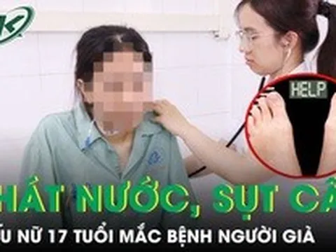 Thiếu nữ 17 tuổi mắc bệnh người già sau nửa tháng khát nước, sụt 5 kg