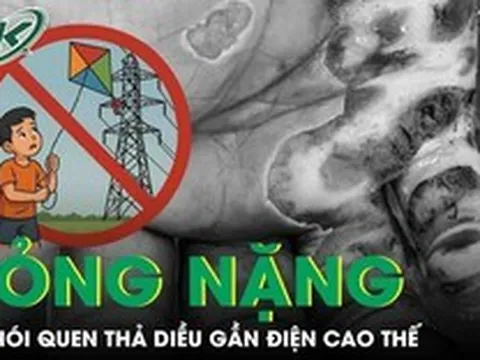 Người đàn ông 57 tuổi bỏng nặng vì thói quen thả diều gần điện cao thế