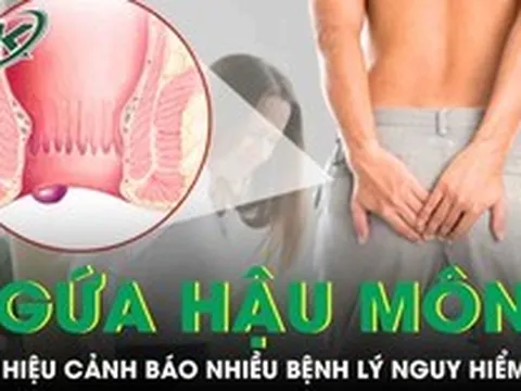 Ngứa hậu môn kéo dài có thể là dấu hiệu cảnh báo nhiều bệnh lý nguy hiểm
