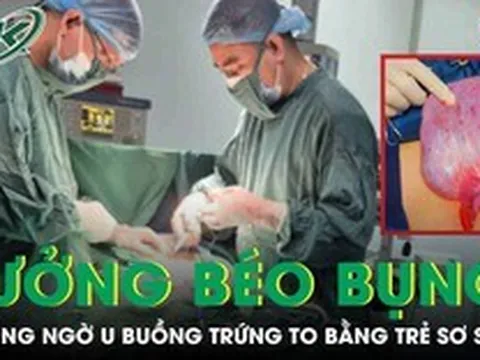 Tưởng bụng to do tuổi tác, người phụ nữ 59 tuổi mang khối u buồng trứng to bằng trẻ sơ sinh