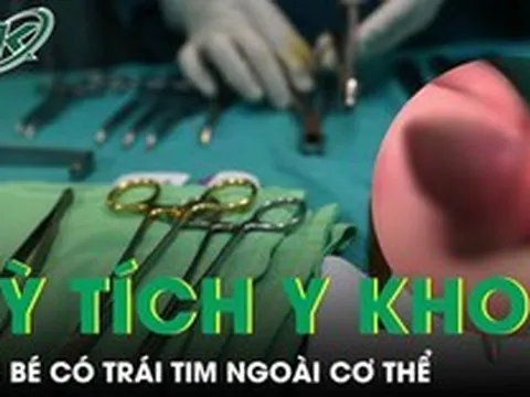 Bé trai chào đời với trái tim nằm ngoài cơ thể