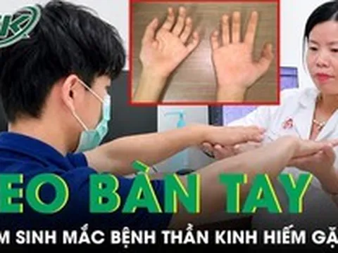 Nam sinh 17 tuổi bàn tay teo nhỏ dần do mắc căn bệnh thần kinh hiếm gặp